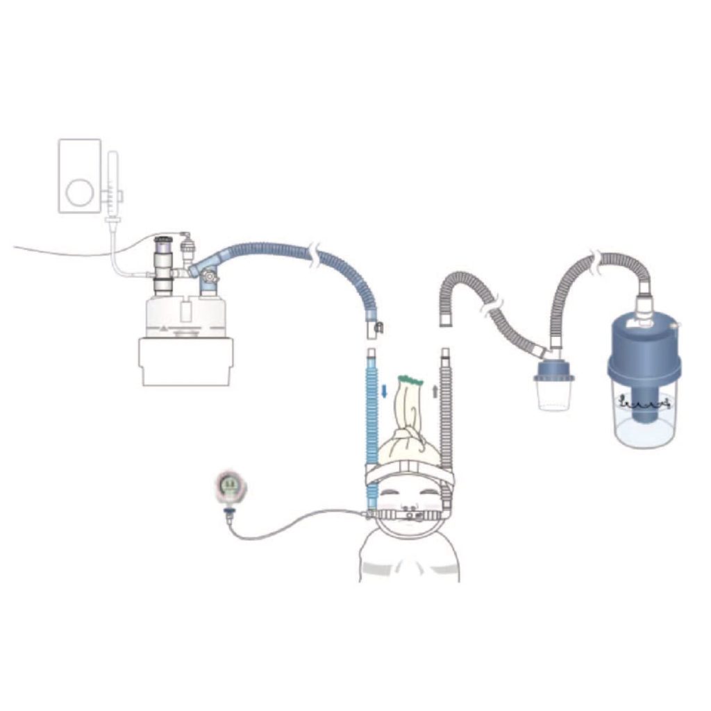 GaleMed-Bubble-CPAP.jpg